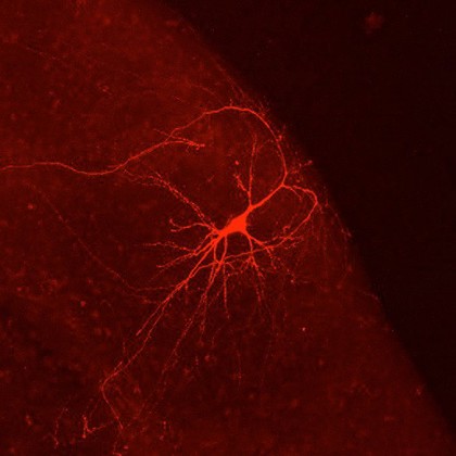 Hippocampal neurone, confocal image