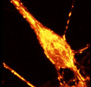 view Confocal, calcium in mitochondria/cell body