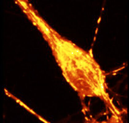 Confocal, calcium in mitochondria/cell body