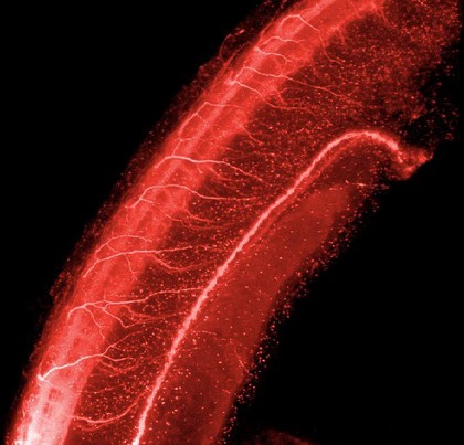 Neural tube of zebrafish embryo (red)