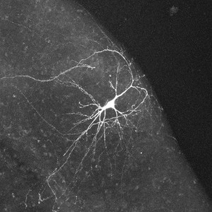 view Confocal image of hippocampal neurone