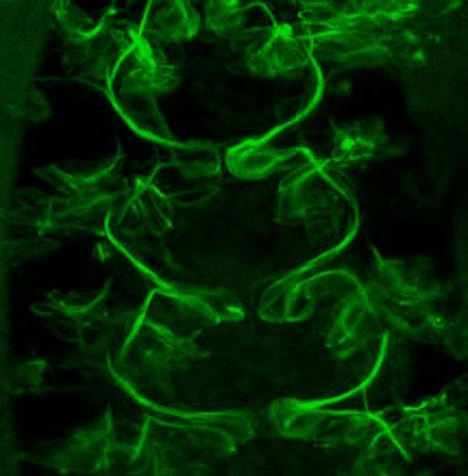 Axons in living embryo, confocal image.