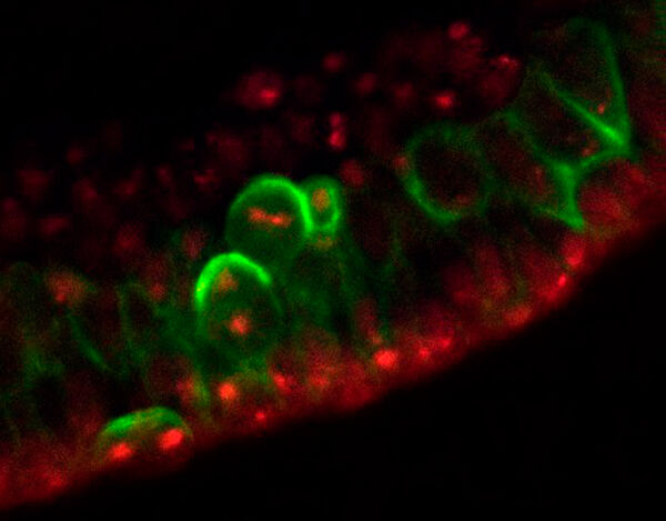 Neuroblast cell division in embryo, confocal