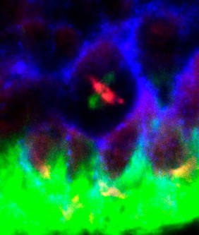 Neuroblast spindle, confocal image