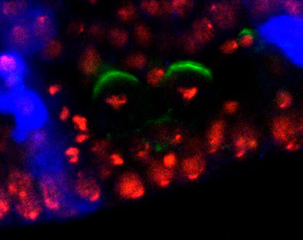 Segregating determinants in embryo, confocal