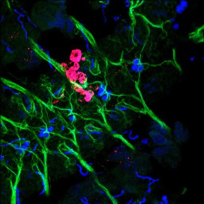 Transplanted cells in nervous system, embryo