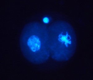 view Location of cyclin in 2-cell human embryo