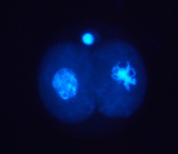 Location of cyclin in 2-cell human embryo