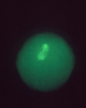 view Location of cyclin in maturing human egg