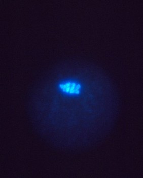 Location of cyclin in maturing human egg