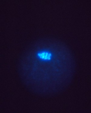 view Location of cyclin in maturing human egg