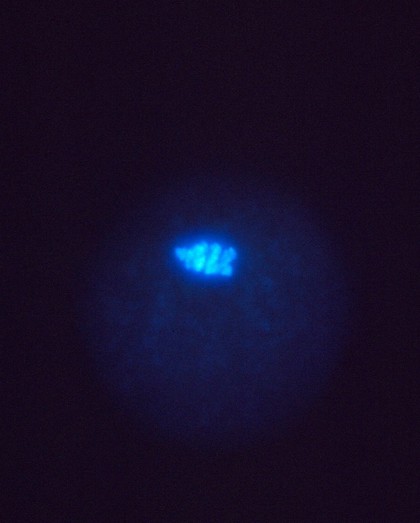 Location of cyclin in maturing human egg