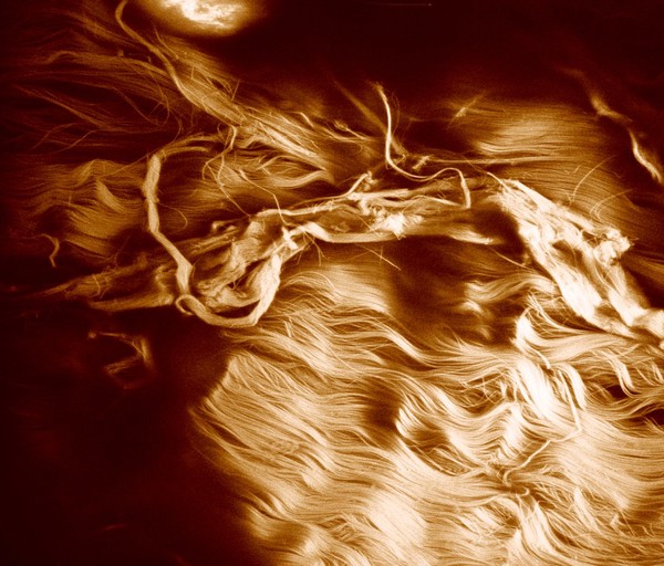 Ruptured tendon - confocal image - coloured