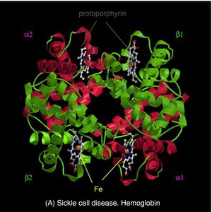 view Sickle cell disease - mol. model haemoglobin