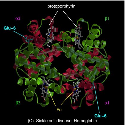 Sickle cell disease - mol. model haemoglobin