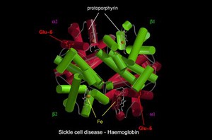 view Sickle cell disease - mol. model haemoglobin