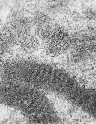 TEM - mitochondria and cell membranes