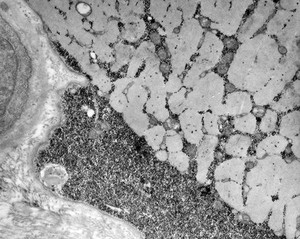 view TEM - glycogen storage in muscle