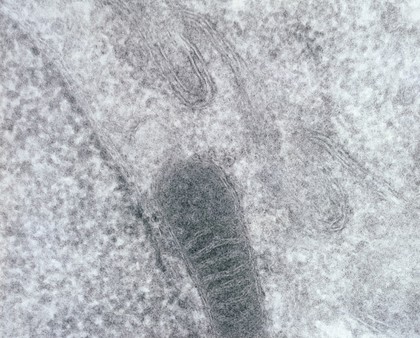 TEM - mitochondrion and cell membranes