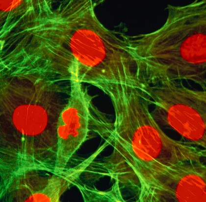 Dividing fibroblasts showing actin and DNA