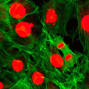 view Dividing fibroblasts showing actin and DNA