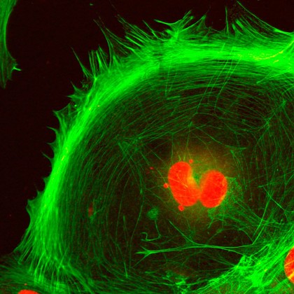 Dividing fibroblast showing actin and DNA