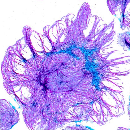 Fibroblast showing actin cytoskeleton - purp