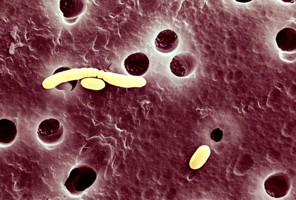 E.coli on nucleopore membrane
