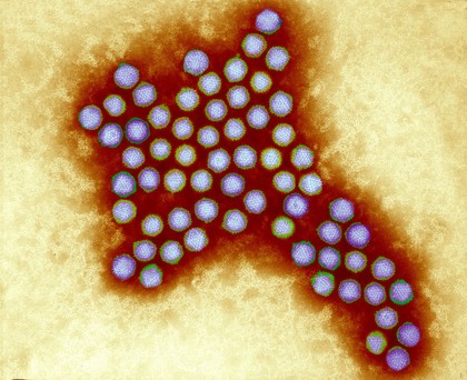 Adenovirus, coloured electron micrograph