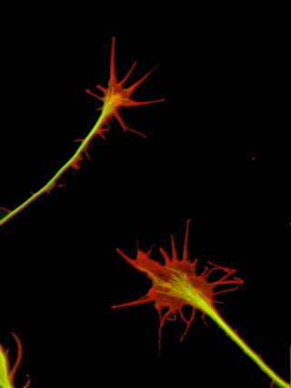 Dorsal Root Ganglion neuron growth cones