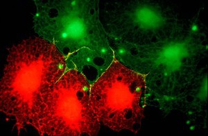 view Injected fibroblast cells in culture