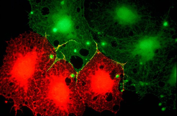 Injected fibroblast cells in culture