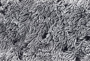 view SEM bronchus,ciliat.epithelium,stereo. RH