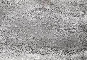 view SEM surface of human bronchus, stereo.,RH