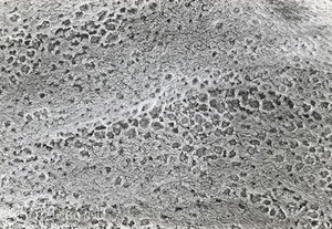 view SEM surface of human bronchus, stereo.,LH