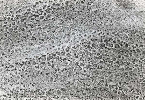 SEM surface of human bronchus, stereo.,LH