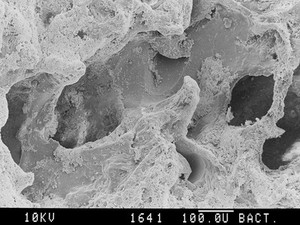 view SEM emphysema in human lung, stereo.,LH