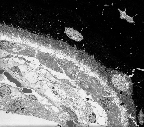 Calcified bone interface showing cell layers