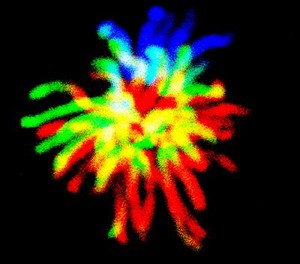 view Human chromosomes in a cancer cell