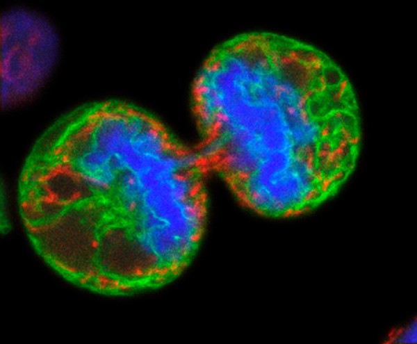 Human melanoma cell dividing