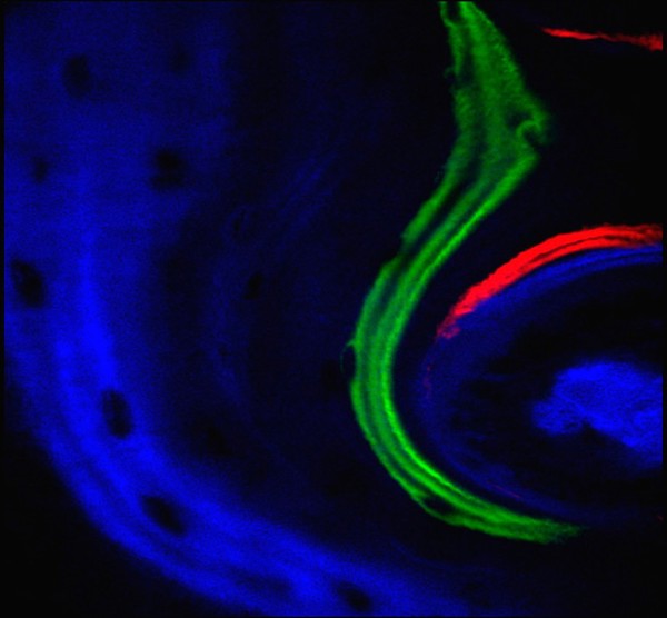 Confocal image of bone growth in culture.