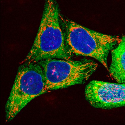 Cells showing DNA, mitochondria and ER