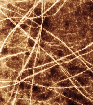 view Network of collagen fibrils