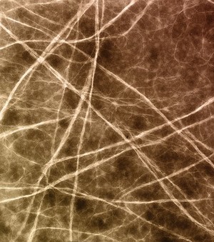 view Network of collagen fibrils