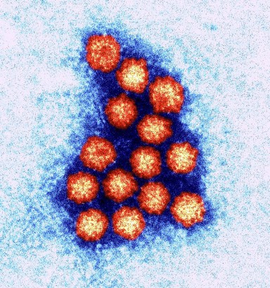 Norovirus - colour-enhanced