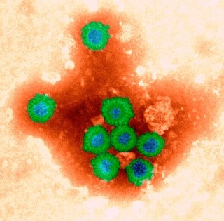 Rotavirus, electron micrograph - coloured