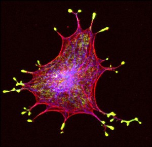 view Melanocyte showing melanosomes