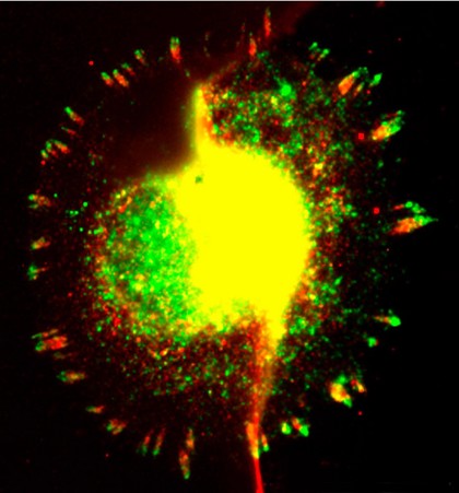 Fibroblast spreading on laminin