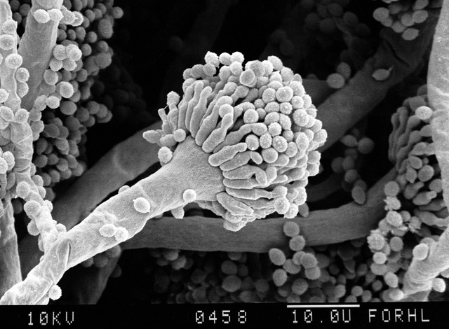 Aspergillus fumigatus, conidia, close-up SEM | Wellcome Collection