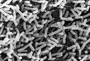 view SEM of E.coli 0157